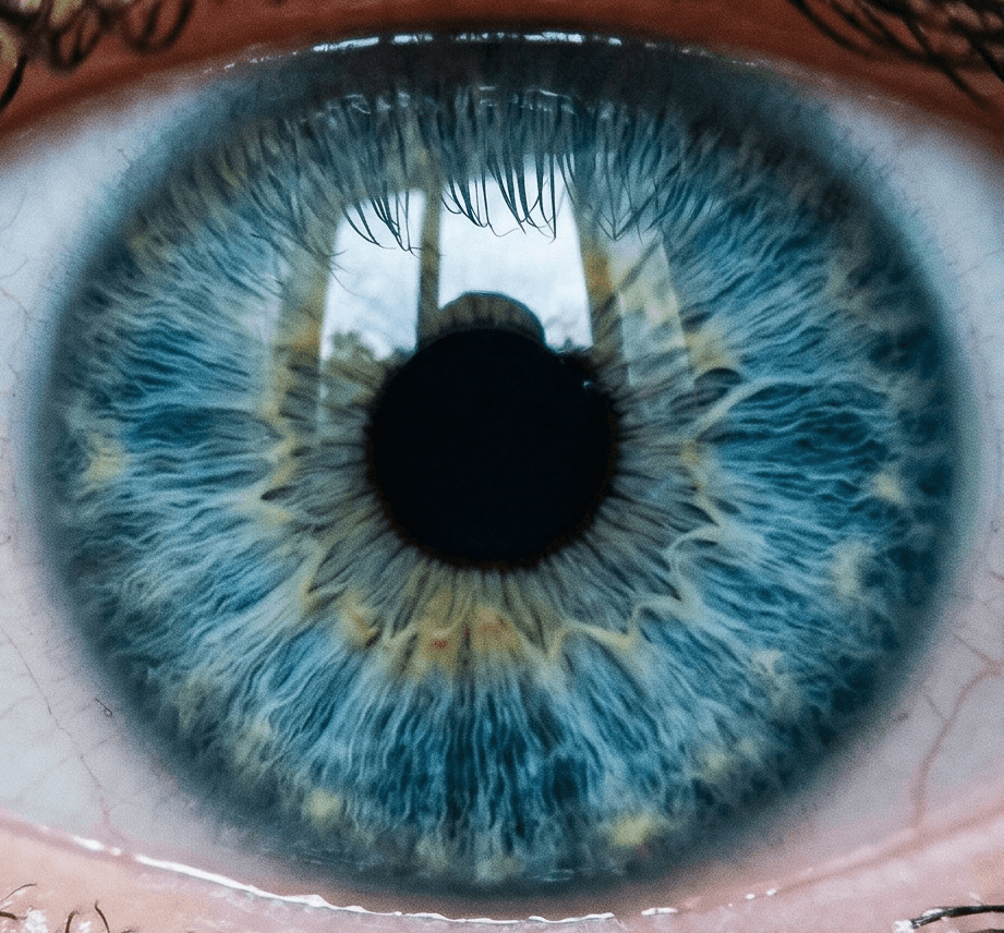 Original eye photograph